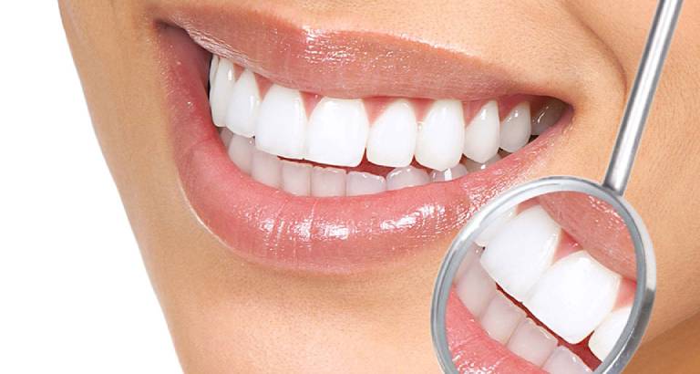 Facetas de Porcelana x Lentes de Contato Dentais: Como deixar meus dentes mais bonitos? 2 lente de contato dental