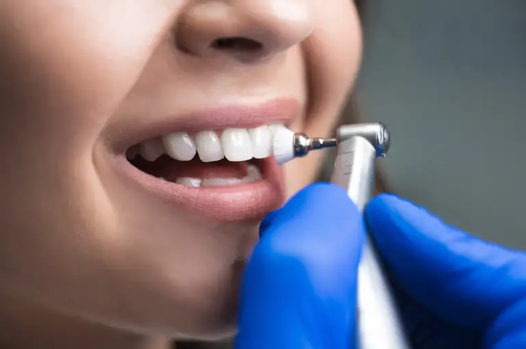 limpeza-dentaria-na-odonto limpeza dentaria na odonto