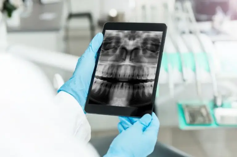 raio-x-radiologia-odontologica-na-odonto raio x radiologia odontologica na odonto