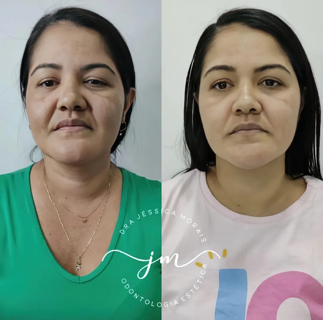 antes-e-depois-2 antes e depois 2