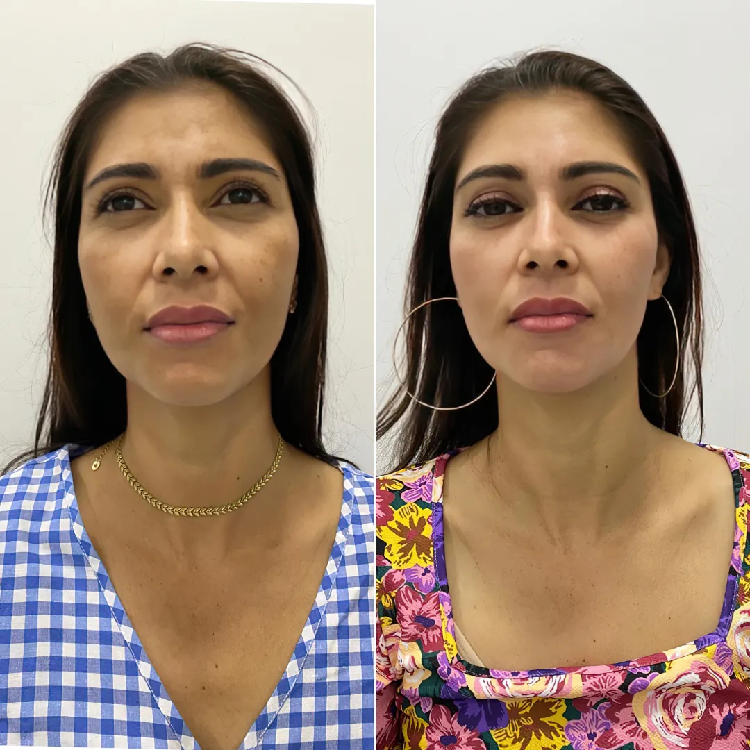 antes-e-depois-3 antes e depois 3