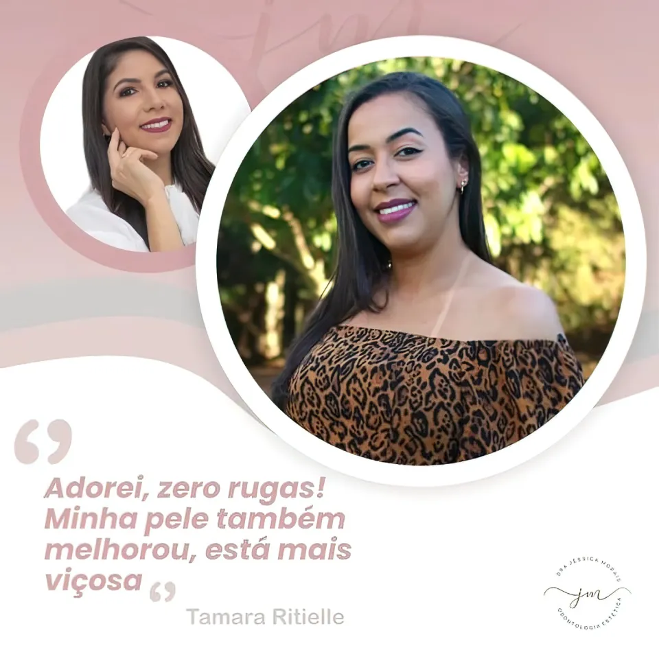 depoimento-tamara-ritielle Paciente Botox Day Bom Jesus da Lapa