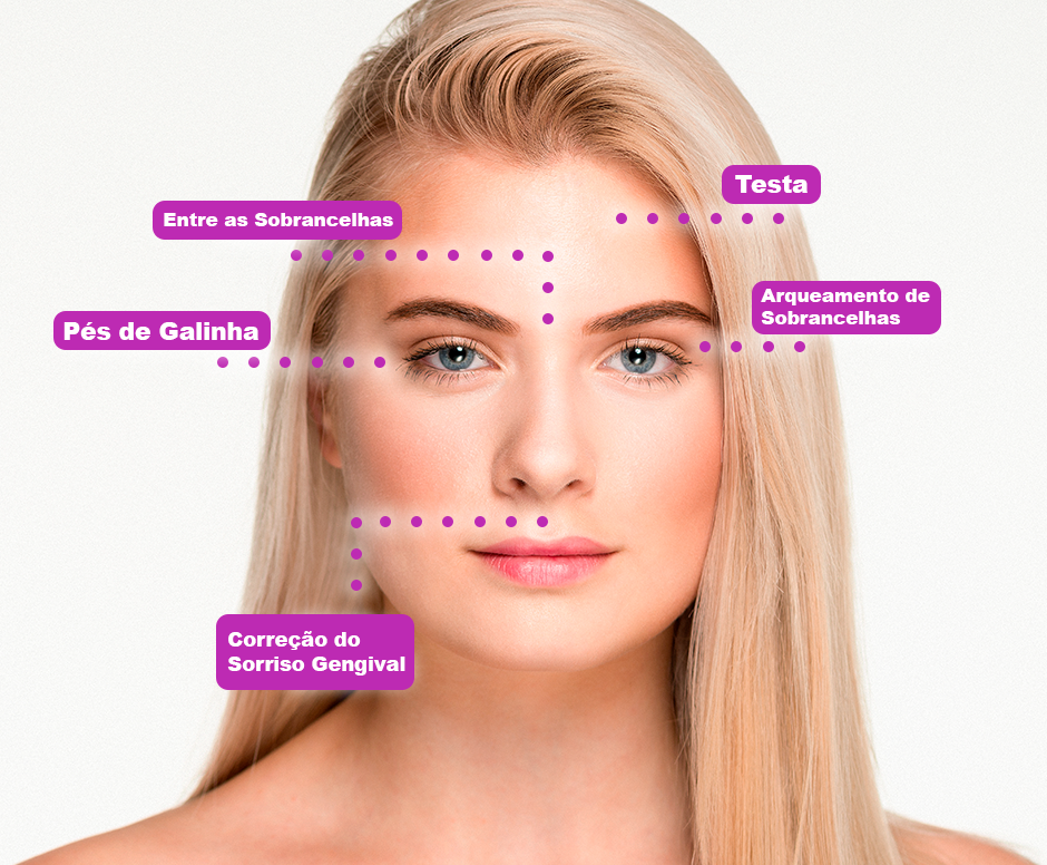 botox-areas-de-aplicacao2 botox areas de aplicacao2